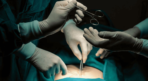 Cirugía de colón en CDMX y Edo. Mex con Especialidad en Cirugía General