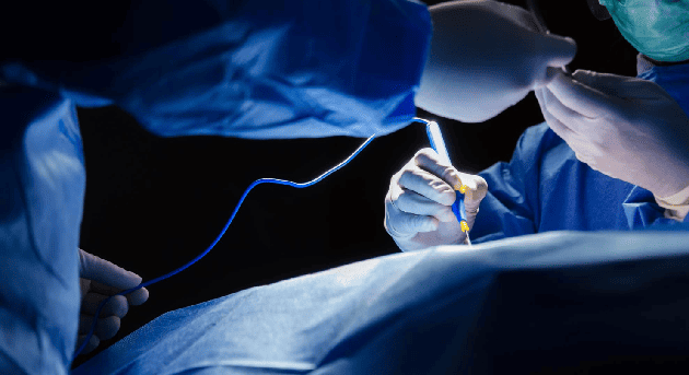 Hemorroidectomía en CDMX y Edo. Mex con Cirugía General